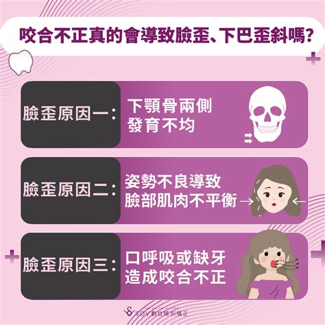 下排牙齒歪斜|咬合不正是什麼？臉歪、下巴後縮該怎麼辦？